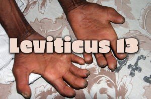 Leviticus 13